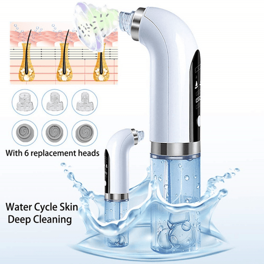 ProClean - Advanced Electric Vacuum Blackhead Remover with Water Cycle Technology for Deep Skin Cleansing, USB Rechargeable, Small Bubbles for Gentle Exfoliation, Portable Beauty Care Tool for Acne Prone Skin, Facial Pore Minimizer