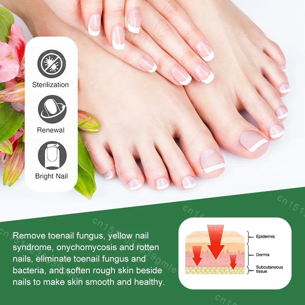 7 Days Nail Fungal Treatment Essence Oil Foot Toe Nail Fungus Removal Serum Repair Onychomycosi Anti Infection Gel Care Products