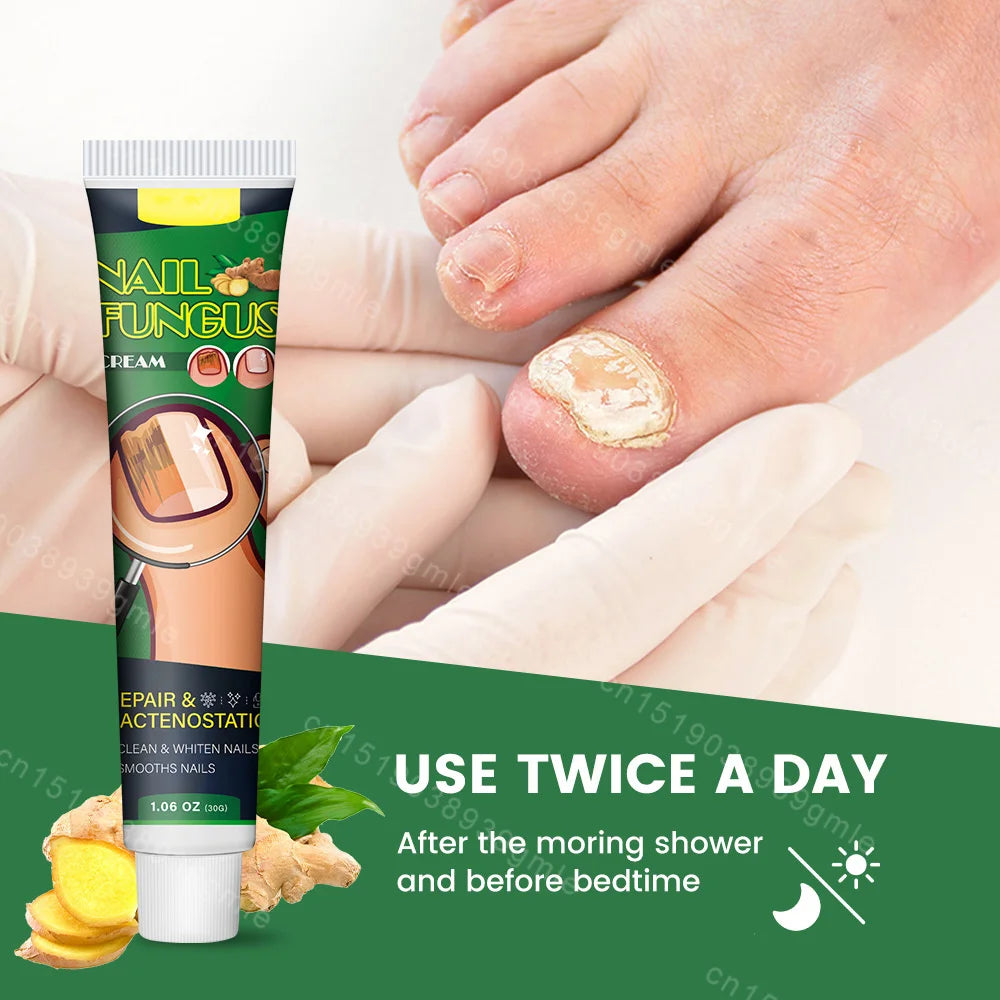 7 Days Nail Fungal Treatment Essence Oil Foot Toe Nail Fungus Removal Serum Repair Onychomycosi Anti Infection Gel Care Products